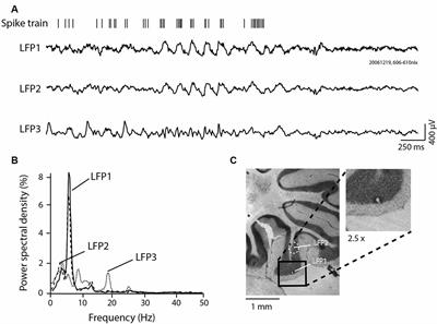 Cerebellar Cortex 4–12 Hz Oscillations and Unit Phase Relation in the Awake Rat